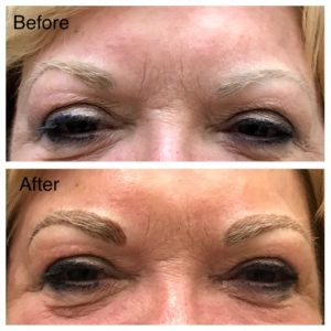 Eyebrows Microblading