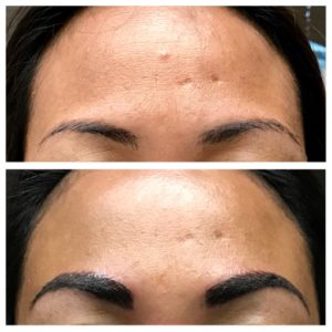 Eyebrows Microblading