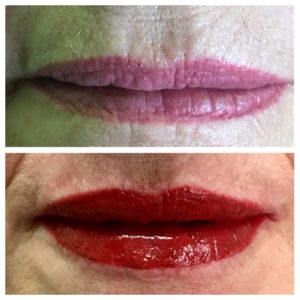 Lip Micropigmentation